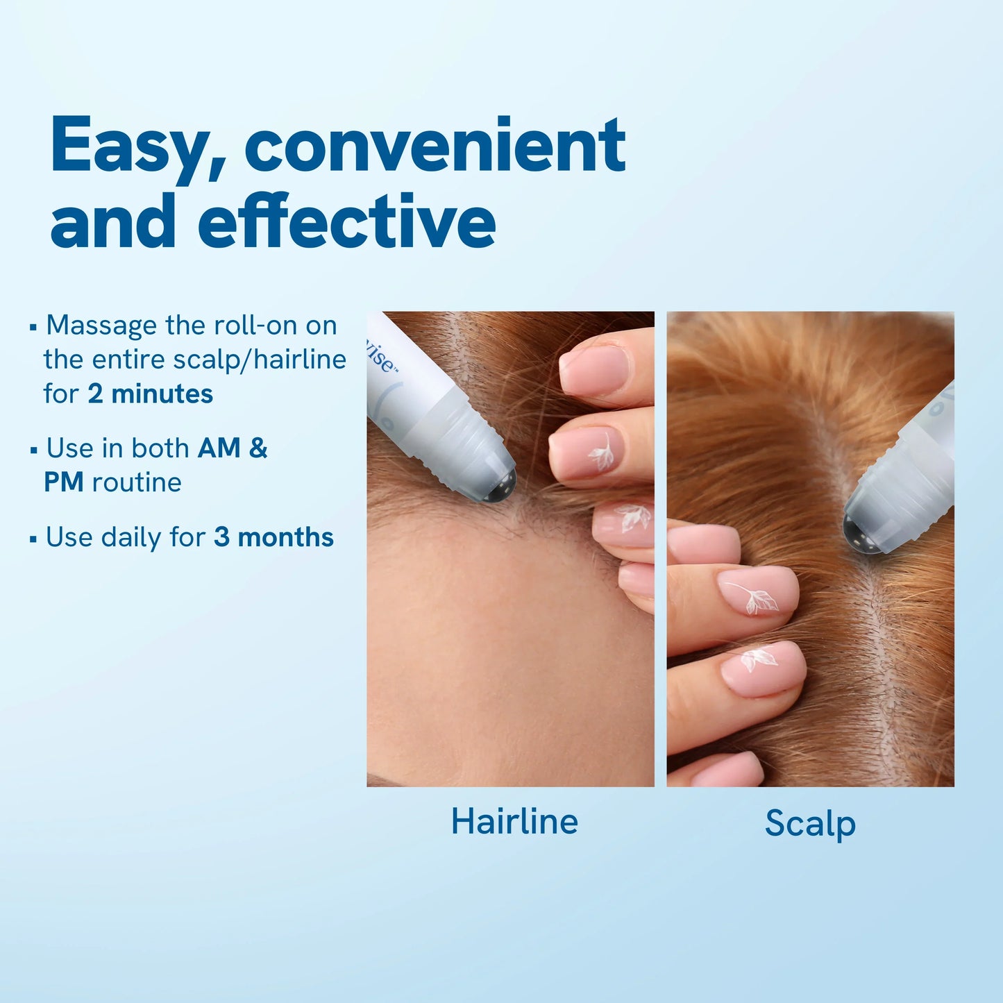 Advanced Hair Growth Roll-On Serum - 25ml